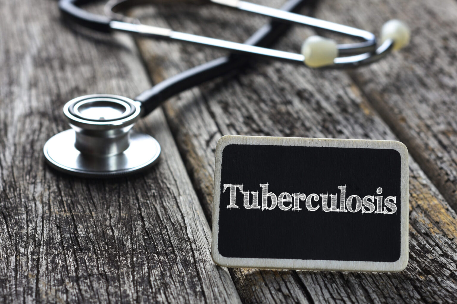 Tuberculosis Exposure Reported at St. Michael’s Catholic Church